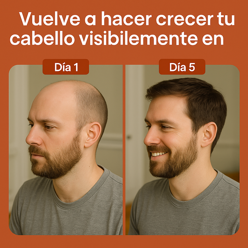 Recupera tu Cabello y Combate la Calvicie con el Poder del Aceite en Marruecos y Oliva